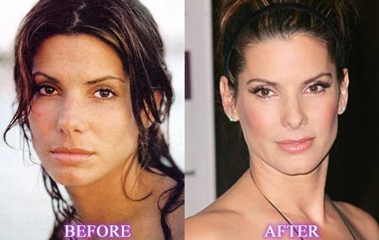 9 Celebrities Who Had Amazing Plastic & Cosmetic Surgery